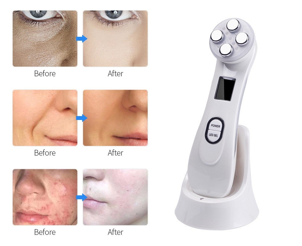 Dispositivo de cuidado de la piel, aparato facial de mesoterapia mediante electroporación de radio frecuencia LED